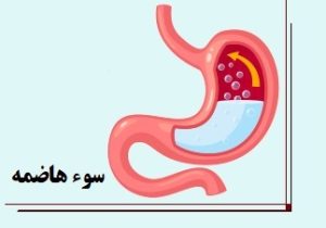 راهکارهای تغذیه‌ای برای کنترل سوءهاضمه؛ از وعده‌های غذایی کوچک تا ماست پروبیوتیک